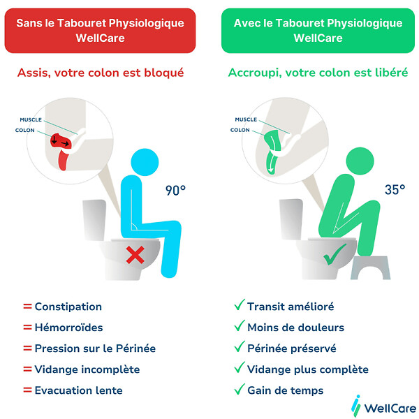 GROHE - WC à poser sans bride Euro Ceramic + Tabouret physiologique Blanc - large