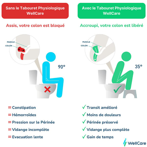 GROHE - WC à poser sans bride Euro Ceramic + Tabouret physiologique Blanc - large